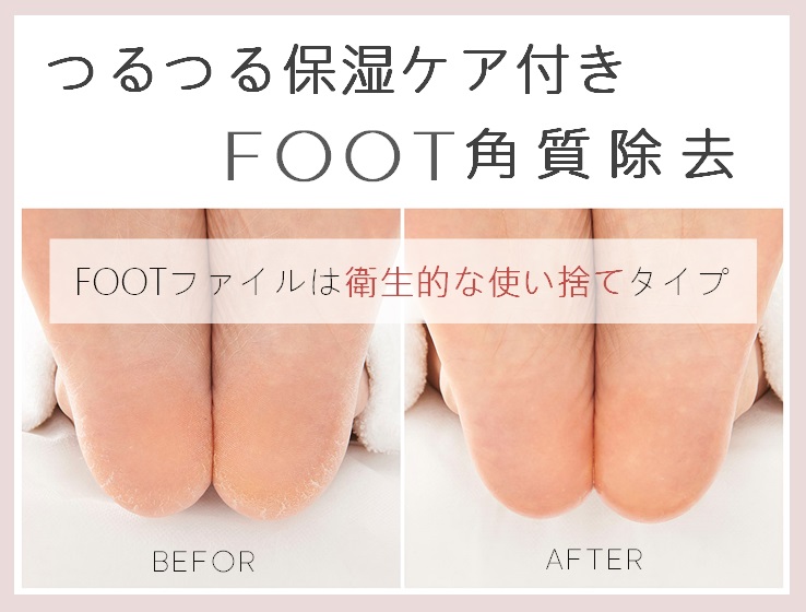 足の角質ケアのメリットとデメリット