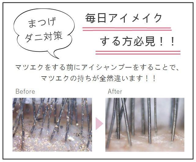 「40代の二人に1人が まつ毛ダニ寄生？！」